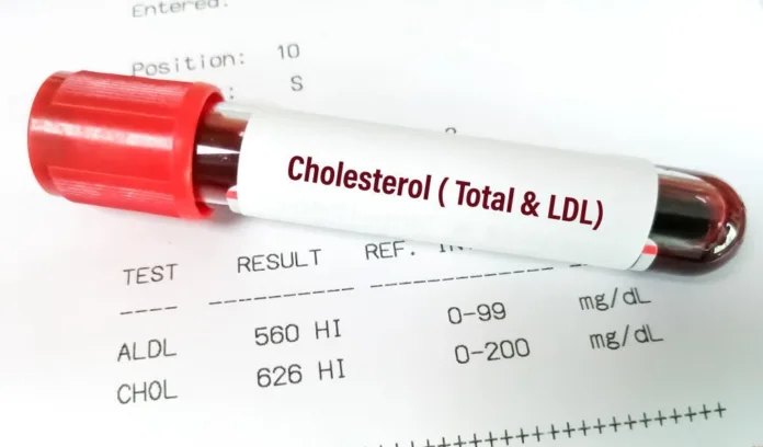 5 Habits That Rapidly Increase Bad Cholesterol In Your Blood - Witapedia