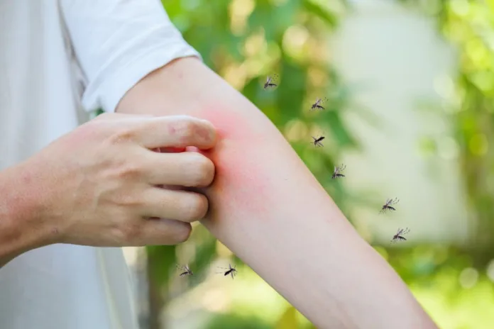 Why do some people get bit by mosquitoes more than others - Witapedia