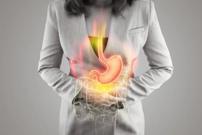 Foods to avoid if you have acid reflux - Witapedia