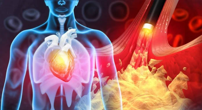 How to Increase Good Cholesterol in your Body - Witapedia