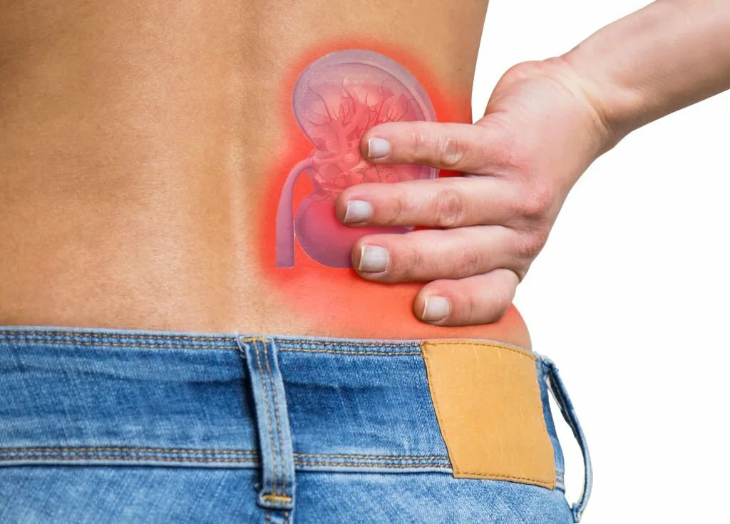 Foods to Avoid If You Have Kidney Stones - Witapedia