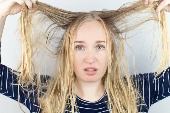 6 Hacks To Fix Oily Hair Instantly - Witapedia