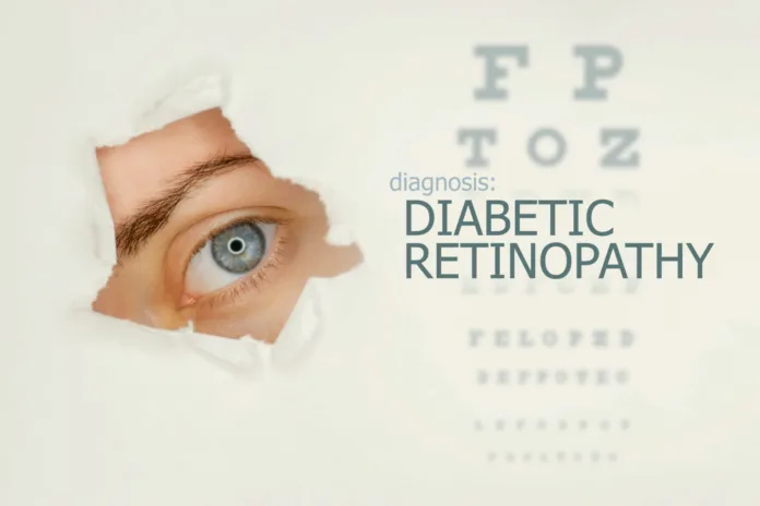 Eye Conditions People With Diabetes May Experience - Witapedia
